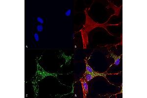 Immunocytochemistry/Immunofluorescence analysis using Mouse Anti-Cav3. (CACNA1G Antikörper  (AA 2052-2172) (FITC))