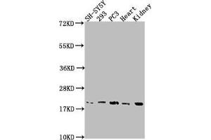 Western Blot Positive WB detected in: SH-SY5Y whole cell lysate, 293 whole cell lysate, PC3 whole cell lysate, Mouse heart tissue, Mouse kidney tissue All lanes: PYCARD antibody at 1:2000 Secondary Goat polyclonal to rabbit IgG at 1/50000 dilution Predicted band size: 22, 20, 16 kDa Observed band size: 20 kDa