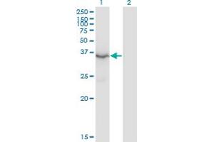 Western Blot analysis of HSD3B2 expression in transfected 293T cell line by HSD3B2 monoclonal antibody (M02), clone 1E8. (HSD3B2 Antikörper  (AA 33-122))