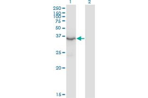HSD3B2 antibody  (AA 33-122)
