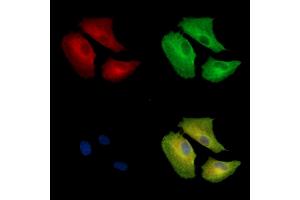 ABIN7096925 and ABIN7100991 staining  cells by IF/ICC.