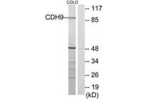 Western Blotting (WB) image for anti-Cadherin 9 (CDH9) (AA 201-250) antibody (ABIN2889889) (Cadherin 9 Antikörper  (AA 201-250))
