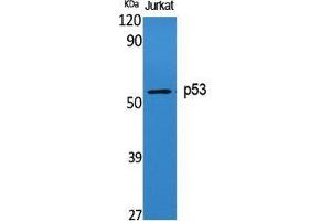 Western Blot (WB) analysis of specific cells using p53 Polyclonal Antibody. (p53 Antikörper  (Tyr191))