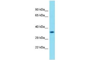 Western Blotting (WB) image for anti-Chromosome 18 Open Reading Frame 8 (C18orf8) (N-Term) antibody (ABIN2156479) (C18orf8 Antikörper  (N-Term))