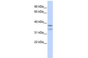 Image no. 1 for anti-Hydrolethalus Syndrome 1 (HYLS1) (AA 216-265) antibody (ABIN6743836) (HYLS1 Antikörper  (AA 216-265))