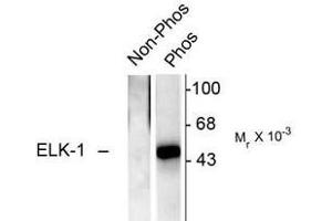 Image no. 2 for anti-ELK1, Member of ETS Oncogene Family (ELK1) (pSer383) antibody (ABIN221173) (ELK1 Antikörper  (pSer383))