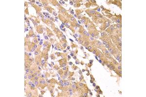 Immunohistochemistry of paraffin-embedded human stomach using SUFU antibody at dilution of 1:100 (x400 lens).
