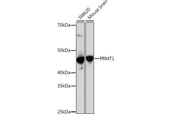 PRMT1 Antikörper