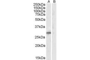 Image no. 1 for anti-E3 Ubiquitin-Protein Ligase SIAH1 (SIAH1) (N-Term) antibody (ABIN374155) (SIAH1 Antikörper  (N-Term))