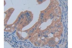 Detection of PFKP in Mouse Ovary Tissue using Polyclonal Antibody to Phosphofructokinase, Platelet (PFKP) (PFKP Antikörper  (AA 247-473))