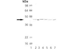 Western blot analysis of PKA: Lane 1: MW marker, Lane 2: CHO-K1, Lane 3: Mouse Brain, Lane 4: Rat Brain, Lane 5: HeLa, Lane 6: 3T3, Lane 7: PC-12. (PKA Antikörper)
