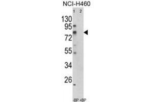 Western Blotting (WB) image for anti-Acyl-CoA Synthetase Short-Chain Family Member 3 (ACSS3) antibody (ABIN3003813) (ACSS3 Antikörper)