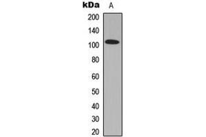 Western blot analysis of GPRIN1 expression in PC3 (A) whole cell lysates. (GPRIN1 Antikörper  (Center))