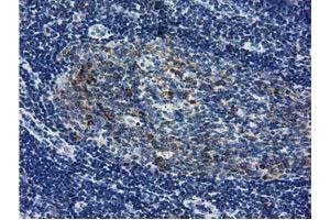 Immunohistochemical staining of paraffin-embedded Human lymph node tissue using anti-LIN7B mouse monoclonal antibody. (LIN7B Antikörper)