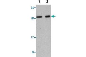 Western blot analysis of human liver tissue with LYRM1 polyclonal antibody  at (Lane 1) 1 and (Lane 2) 2 ug/mL dilution.