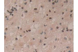 Immunohistochemistry (IHC) image for anti-Hepatoma-Derived Growth Factor (HDGF) (AA 10-240) antibody (ABIN7432232)