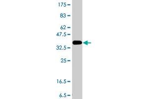 Western Blot detection against Immunogen (37. (ALDH1L1 Antikörper  (AA 803-902))