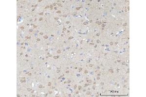 IHC analysis of SSH3BP1/ABI1 using anti-SSH3BP1/ABI1 antibody (ABIN3043515).