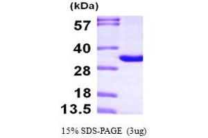 SDS-PAGE (SDS) image for Thymocyte Nuclear Protein 1 (THYN1) (AA 1-225) protein (His tag) (ABIN667247)