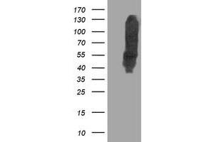 Western Blotting (WB) image for anti-Dihydrolipoamide Dehydrogenase (DLD) antibody (ABIN1497847) (DLD Antikörper)