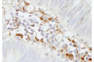 Immunohistochemistry (IHC) image for anti-Filamin A, alpha (FLNA) (AA 1725-1775) antibody (ABIN7448965) (Filamin A Antikörper  (AA 1725-1775))