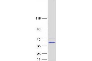 Western Blotting (WB) image for Dehydrodolichyl Diphosphate Synthase (DHDDS) (Transcript Variant 1) protein (Myc-DYKDDDDK Tag) (ABIN2719330)