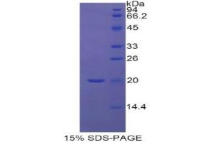 SDS-PAGE (SDS) image for Retinol Binding Protein 5, Cellular (RBP5) (AA 2-135) protein (His tag) (ABIN2126676) (Retinol Binding Protein 5 Protein (AA 2-135) (His tag))