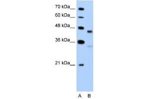 GPR161 antibody used at 5 ug/ml to detect target protein. (GPR161 Antikörper  (C-Term))