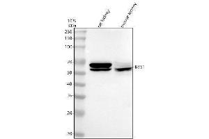Western blot analysis of BBS1 using anti-BBS1 antibody (ABIN7599713).