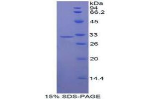 SDS-PAGE analysis of Human Janus Kinase 1 Protein.