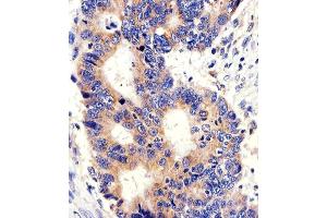 Immunohistochemical analysis of paraffin-embedded H.