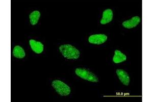 Image no. 2 for anti-Transcription Factor 7 (T-Cell Specific, HMG-Box) (TCF7) (AA 287-385) antibody (ABIN598962) (TCF7 Antikörper  (AA 287-385))