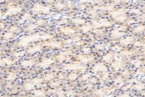 Immunohistochemistry (Paraffin-embedded Sections) (IHC (p)) image for anti-Isovaleryl-CoA Dehydrogenase (IVD) antibody (ABIN7074382)
