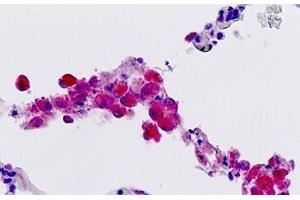 Human, Lung, Macrophages: Formalin-Fixed Paraffin-Embedded (FFPE) (FFAR2 Antikörper  (AA 286-315))