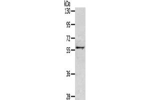 Gel: 6 % SDS-PAGE, Lysate: 40 μg, Lane: Mouse intestines tissue, Primary antibody: ABIN7130495(OLFM3 Antibody) at dilution 1/200, Secondary antibody: Goat anti rabbit IgG at 1/8000 dilution, Exposure time: 2 minutes (Olfactomedin 3 Antikörper)