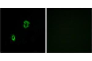 Immunofluorescence analysis of A549 cells, using CCR7 Antibody. (CCR7 Antikörper  (AA 170-219))