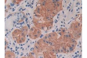 Detection of CTXI in Human Stomach Tissue using Monoclonal Antibody to Cross Linked C-Telopeptide Of Type I Collagen (CTXI)