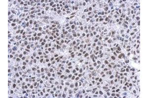 Immunohistochemistry (IHC) image for anti-Nuclear Receptor Subfamily 3, Group C, Member 1 (Glucocorticoid Receptor) (NR3C1) (N-Term) antibody (ABIN2854939)