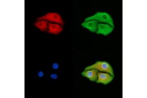 ABIN6259253 and ABIN6275428 staining Hela cells by IF/ICC. (PDXDC1 Antikörper  (C-Term))