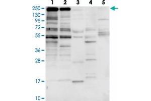 Western blot analysis of Lane 1: RT-4, Lane 2: U-251 MG, Lane 3: Human Plasma, Lane 4: Liver, Lane 5: Tonsil with ZNF646 polyclonal antibody  at 1:250-1:500 dilution. (ZNF646 Antikörper)
