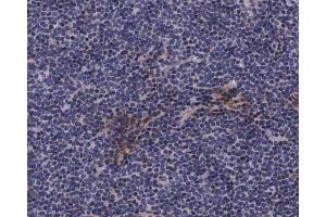 ABIN6267620 at 1/200 staining human lymph nodes tissue sections by IHC-P.