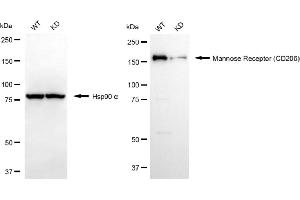 Western blotting analysis using mannose receptor (CD206) antibody (ABIN7799329). (Rekombinanter Mannose Receptor Antikörper)