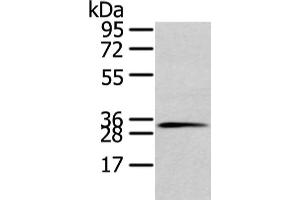 Gel: 10 % SDS-PAGE, Lysate: 80 μg, Lane: 231 cell, Primary antibody: ABIN7128026(STX19 Antibody) at dilution 1/800 dilution, Secondary antibody: Goat anti rabbit IgG at 1/8000 dilution, Exposure time: 10 seconds (Syntaxin 19 Antikörper)