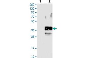 Western blot analysis of Lane 1: Negative control (vector only transfected HEK293T lysate). (SLC10A2 Antikörper)