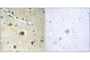 Immunohistochemistry analysis of paraffin-embedded human brain tissue, using Collagen IV alpha4 Antibody.