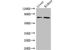 Western Blot Positive WB detected in: Mouse liver tissue, Mouse kidney tissue All lanes: ZFP64 antibody at 4 μg/mL Secondary Goat polyclonal to rabbit IgG at 1/50000 dilution Predicted band size: 75, 69, 73, 49, 47 kDa Observed band size: 75 kDa (ZFP64 Antikörper  (AA 70-342))