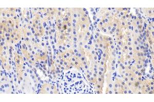 Detection of IL18 in Porcine Kidney Tissue using Polyclonal Antibody to Interleukin 18 (IL18) (IL-18 Antikörper  (AA 36-192))