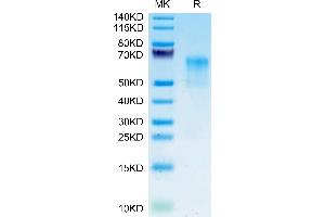 CD235a/GYPA Protein (AA 20-91) (Fc Tag)