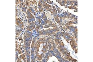 IHC analysis of SNPH using anti-SNPH antibody (ABIN7601724). (Syntaphilin Antikörper  (AA 43-482))