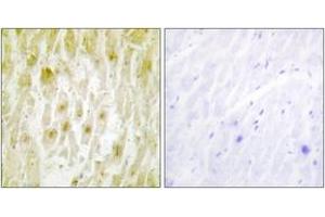 Immunohistochemistry analysis of paraffin-embedded human heart tissue, using TF2E2 Antibody. (GTF2E2 Antikörper  (AA 151-200))